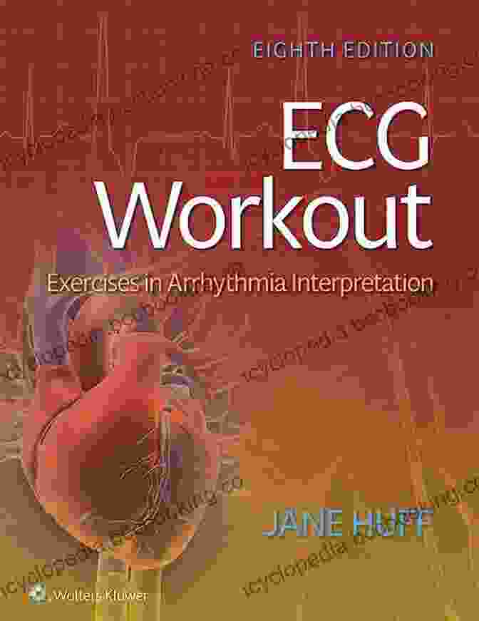 ECG Workout Exercises In Arrhythmia Interpretation Book Cover ECG Workout: Exercises In Arrhythmia Interpretation
